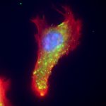 Epifluorescence image of extracellular vimentin (green), here seen with the protein actin (red) and DNA (blue), speeds up delivery of SARS2 to the cell. Anti-vimentin antibodies can block up to 80% of host cell invasion in the coronavirus. (Courtesy: Maxx Swoger and Alison Patteson)